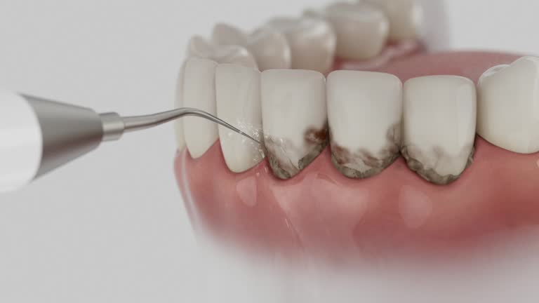 Reliable Emergency Dentist contractor in Christopher, IL by Smile Center Dentistry
